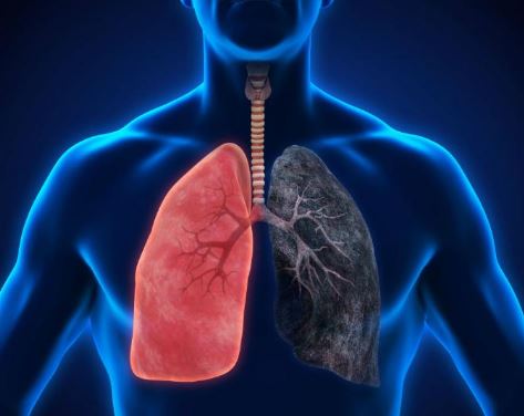 Cần sa gây các bệnh về phổi